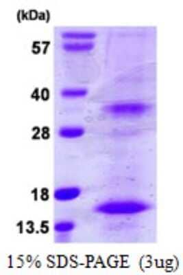 SDS-PAGE: Recombinant Human BST2 His Protein [NBP1-72363]