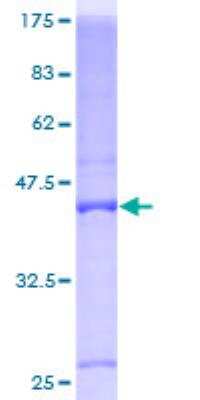 SDS-PAGE: Recombinant Human BTG1 GST (N-Term) Protein [H00000694-P01]