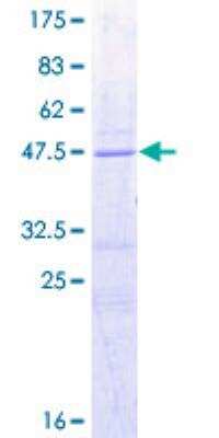 SDS-PAGE: Recombinant Human Bad GST (N-Term) Protein [H00000572-P01]