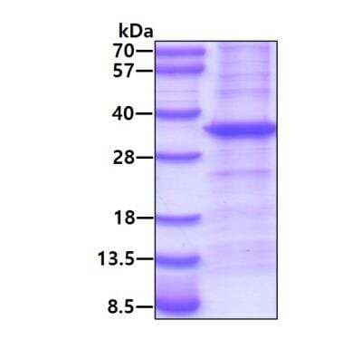 SDS-PAGE: Recombinant Human Bcl-10 His Protein [NBP1-99064]