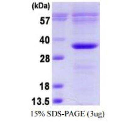 SDS-PAGE: Recombinant Human Bcl-10 His Protein [NBP1-99064]