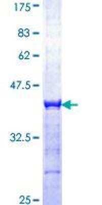 SDS-PAGE: Recombinant Human Bcl-6 GST (N-Term) Protein [H00000604-Q01]