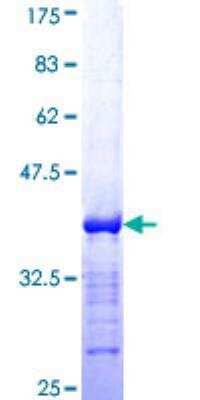 SDS-PAGE: Recombinant Human Bcl-9 GST (N-Term) Protein [H00000607-Q01]