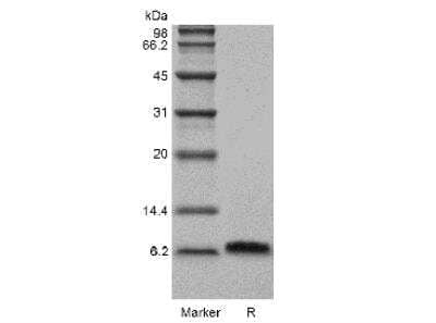 SDS-PAGE: Recombinant Human Beta-Defensin 5 Protein [NBP2-34917]