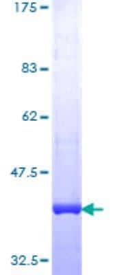 SDS-PAGE: Recombinant Human Blooms Syndrome Protein Blm GST (N-Term) Protein [H00000641-Q01]