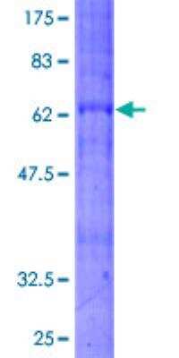 SDS-PAGE: Recombinant Human Bradykinin RB2/BDKRB2 GST (N-Term) Protein [H00000624-P01]