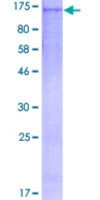 SDS-PAGE: Recombinant Human Bub1 GST (N-Term) Protein [H00000699-P01]