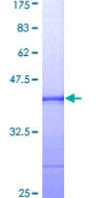 SDS-PAGE: Recombinant Human Bub1 GST (N-Term) Protein [H00000699-Q01]