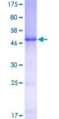 SDS-PAGE: Recombinant Human C1QB GST (N-Term) Protein [H00000713-P01]