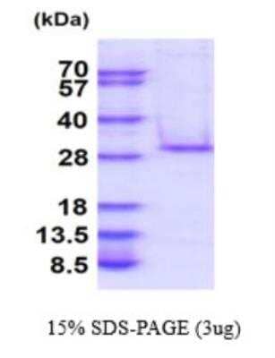 SDS-PAGE: Recombinant Human C1qTNF5/CTRP5 His Protein [NBP2-77501]