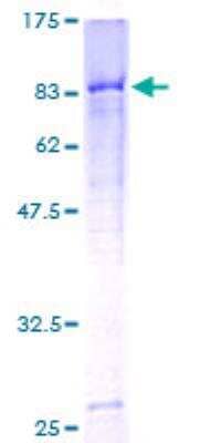 SDS-PAGE: Recombinant Human C4 binding protein A GST (N-Term) Protein [H00000722-P01]