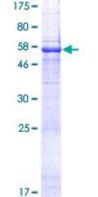 SDS-PAGE: Recombinant Human C5orf36 GST (N-Term) Protein [H00285600-P01]