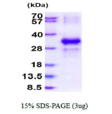 SDS-PAGE: Recombinant Human YAE1 His Protein [NBP2-22954]