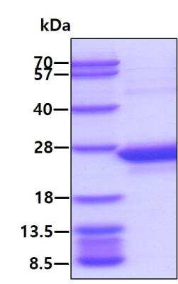 SDS-PAGE: Recombinant Human C8G His Protein [NBP1-72476]