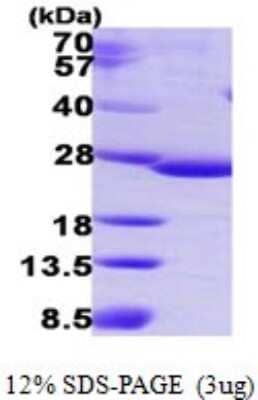 SDS-PAGE: Recombinant Human C9orf103 His Protein [NBP1-78877]