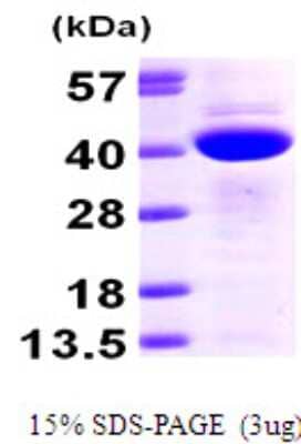 SDS-PAGE: Recombinant Human CAB39 His Protein [NBP1-50834]