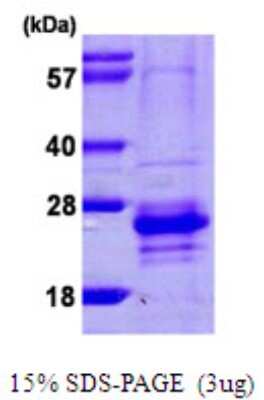 SDS-PAGE: Recombinant Human CABP7 His Protein [NBP1-51094]