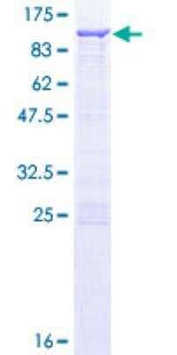 SDS-PAGE: Recombinant Human CACNB1 GST (N-Term) Protein [H00000782-P01]