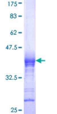 SDS-PAGE: Recombinant Human CACNB2 GST (N-Term) Protein [H00000783-Q01]