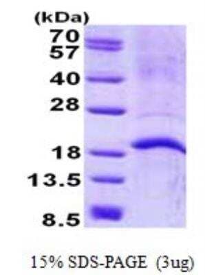 SDS-PAGE: Recombinant Human CAMP/LL37/FALL39/Cathelicidin His Protein [NBP2-22738]