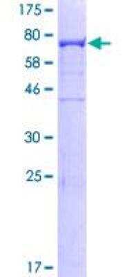 SDS-PAGE: Recombinant Human CAP1 GST (N-Term) Protein [H00010487-P01]