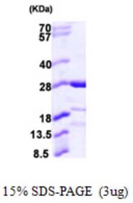 SDS-PAGE: Recombinant Human CAPSL His Protein [NBP1-51049]