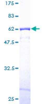 SDS-PAGE: Recombinant Human CAPZA1 GST (N-Term) Protein [H00000829-P01]