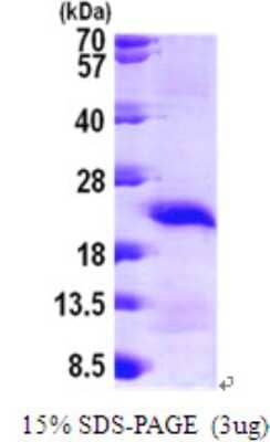 SDS-PAGE: Recombinant Human CARHSP1 His Protein [NBP1-49164]