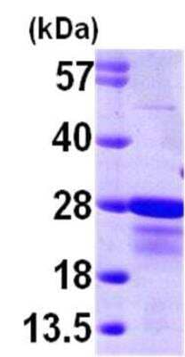 SDS-PAGE: Recombinant Human CBFB His Protein [NBP1-45317]