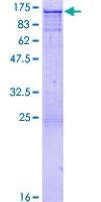 SDS-PAGE: Recombinant Human CBL GST (N-Term) Protein [H00000867-P01]