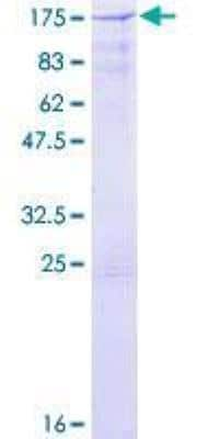 SDS-PAGE: Recombinant Human CBLB GST (N-Term) Protein [H00000868-P01]