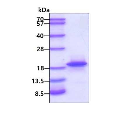 SDS-PAGE: Recombinant Human CBP20 His Protein [NBP1-49435]