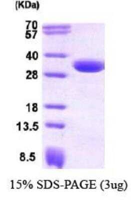 SDS-PAGE: Recombinant Human CBR1 Protein [NBC1-26370]