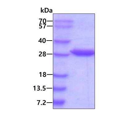 SDS-PAGE: Recombinant Human CBR4 His Protein [NBP1-50867]