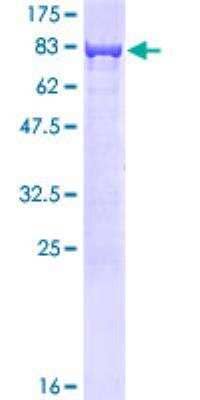 SDS-PAGE: Recombinant Human CBS GST (N-Term) Protein [H00000875-P01]