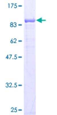 SDS-PAGE: Recombinant Human CBS GST (N-Term) Protein [H00000875-P02]