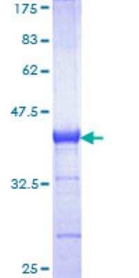 SDS-PAGE: Recombinant Human CBS GST (N-Term) Protein [H00000875-Q01]