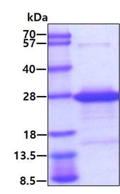 SDS-PAGE: Recombinant Human CBX3 His Protein [NBP1-99065]