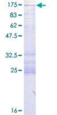 SDS-PAGE: Recombinant Human CC2D1A GST (N-Term) Protein [H00054862-P01]