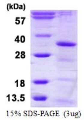 SDS-PAGE: Recombinant Human CCDC5 His Protein [NBP1-99034]