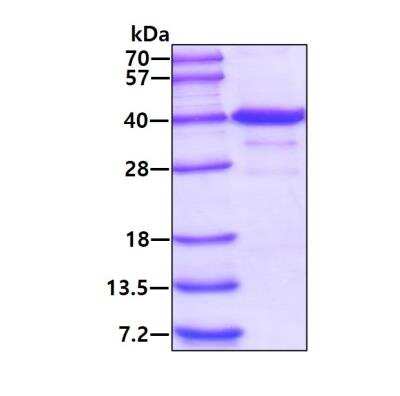 SDS-PAGE: Recombinant Human CCM2 His Protein [NBP2-22769]