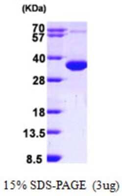 SDS-PAGE: Recombinant Human CCS/SOD4 His Protein [NBP1-48393]