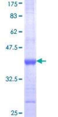 SDS-PAGE: Recombinant Human CD11b GST (N-Term) Protein [H00003684-Q01]