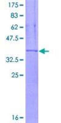 SDS-PAGE: Recombinant Human CD11c GST (N-Term) Protein [H00003687-Q01]