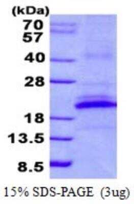 SDS-PAGE: Recombinant Human CD161 His Protein [NBP2-23169]