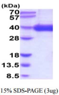 SDS-PAGE: Recombinant Human CD1a His Protein [NBP2-59662]