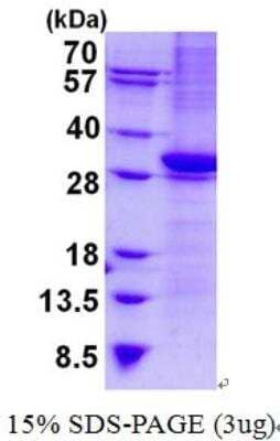 SDS-PAGE: Recombinant Human CD1b His Protein [NBP2-22744]