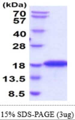 SDS-PAGE: Recombinant Mouse CD1d His Protein [NBP2-61190]