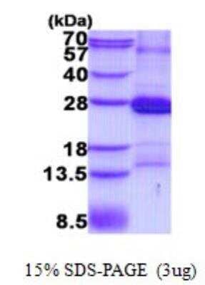 SDS-PAGE: Recombinant Human CD2 His Protein [NBP2-22745]