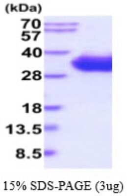 SDS-PAGE: Recombinant Human CD2 His Protein [NBP2-59526]